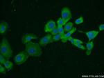 NUMB Antibody in Immunocytochemistry (ICC/IF)