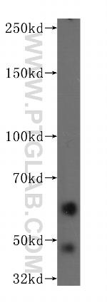 NUMB Antibody in Western Blot (WB)