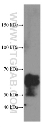 NUMB Antibody in Western Blot (WB)