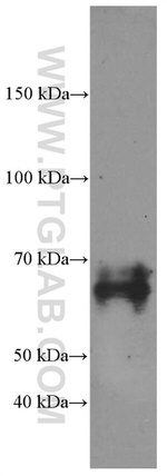 NUMB Antibody in Western Blot (WB)