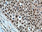 GSTO1 Antibody in Immunohistochemistry (Paraffin) (IHC (P))