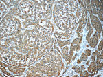 GSTO1 Antibody in Immunohistochemistry (Paraffin) (IHC (P))