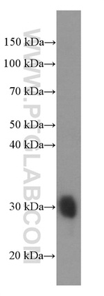 GSTO1 Antibody in Western Blot (WB)