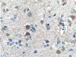 CUL4B Antibody in Immunohistochemistry (Paraffin) (IHC (P))