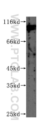 CUL4B Antibody in Western Blot (WB)