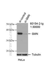SMN Antibody in Western Blot (WB)