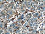EPHA1 Antibody in Immunohistochemistry (Paraffin) (IHC (P))