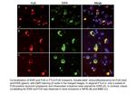 FUS/TLS Antibody in Immunocytochemistry (ICC/IF)