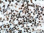 FUS/TLS Antibody in Immunohistochemistry (Paraffin) (IHC (P))