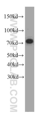 FUS/TLS Antibody in Western Blot (WB)