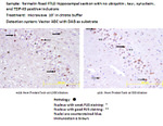 FUS/TLS Antibody in Immunohistochemistry (IHC)