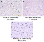 FUS/TLS Antibody in Immunohistochemistry (IHC)