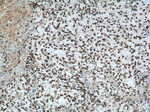 FUS/TLS Antibody in Immunohistochemistry (Paraffin) (IHC (P))
