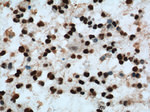 FUS/TLS Antibody in Immunohistochemistry (Paraffin) (IHC (P))