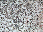 FUS/TLS Antibody in Immunohistochemistry (Paraffin) (IHC (P))