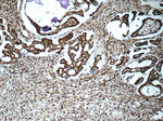 FUS/TLS Antibody in Immunohistochemistry (Paraffin) (IHC (P))