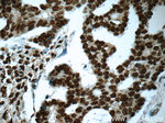 FUS/TLS Antibody in Immunohistochemistry (Paraffin) (IHC (P))