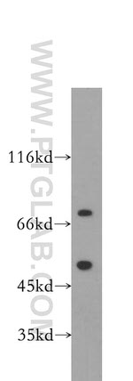 FUS/TLS Antibody in Western Blot (WB)