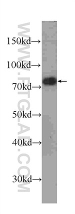 FUS/TLS Antibody in Western Blot (WB)