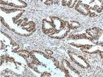 MSH2 Antibody in Immunohistochemistry (Paraffin) (IHC (P))