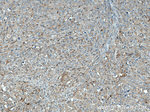 LCK Antibody in Immunohistochemistry (Paraffin) (IHC (P))
