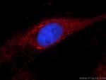 ALDH1A1 Antibody in Immunocytochemistry (ICC/IF)