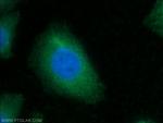 CKM Antibody in Immunocytochemistry (ICC/IF)