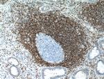 BCL2 Antibody in Immunohistochemistry (Paraffin) (IHC (P))