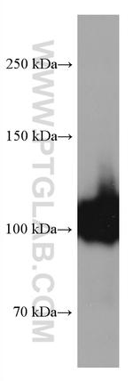 CD34 Antibody in Western Blot (WB)