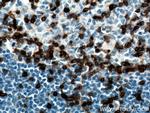 CD3 Antibody in Immunohistochemistry (Paraffin) (IHC (P))