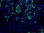 Cytokeratin 19 Antibody in Immunohistochemistry (PFA fixed) (IHC (PFA))