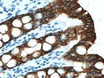 Cytokeratin 19 Antibody in Immunohistochemistry (Paraffin) (IHC (P))