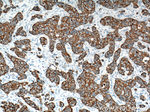 Cytokeratin 19 Antibody in Immunohistochemistry (Paraffin) (IHC (P))