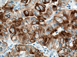 Cytokeratin 19 Antibody in Immunohistochemistry (Paraffin) (IHC (P))