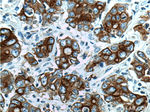 Cytokeratin 19 Antibody in Immunohistochemistry (Paraffin) (IHC (P))