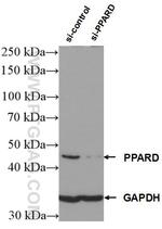 PPARD Antibody in Western Blot (WB)