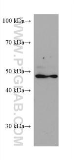 PPARD Antibody in Western Blot (WB)