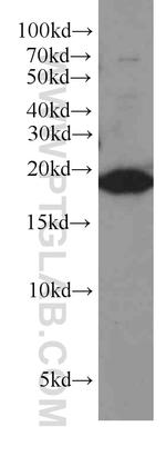 TMEM70 Antibody in Western Blot (WB)