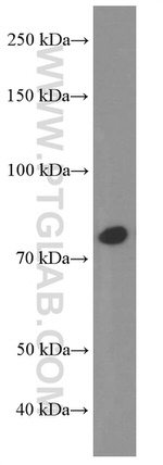 STAT3 Antibody in Western Blot (WB)