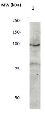 Catenin-Delta1 Antibody in Western Blot (WB)