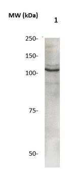 Phospho-Catenin-Delta1 (Tyr228) Antibody in Western Blot (WB)