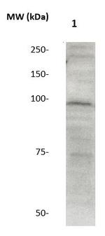 Catenin-Delta1 Antibody in Western Blot (WB)