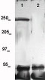 Phospho-VEGFR-2 (CD309) (Tyr951) Antibody in Western Blot (WB)