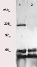 VEGFR-2 (CD309) Antibody in Western Blot (WB)