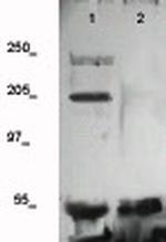 VEGFR-2 (CD309) Antibody in Western Blot (WB)