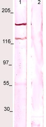 Phospho-CSF-1R (Tyr723) Antibody in Western Blot (WB)