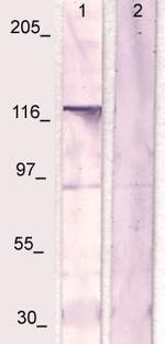 CSF-1R Antibody in Western Blot (WB)