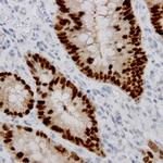 CDC2 Antibody in Immunohistochemistry (Paraffin) (IHC (P))
