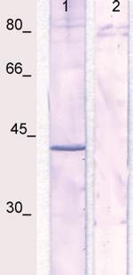 Phospho-IkBa (NFkB1A) (Ser32, Ser36) Antibody in Western Blot (WB)