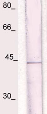 IkBa (NFKB1A) Antibody in Western Blot (WB)